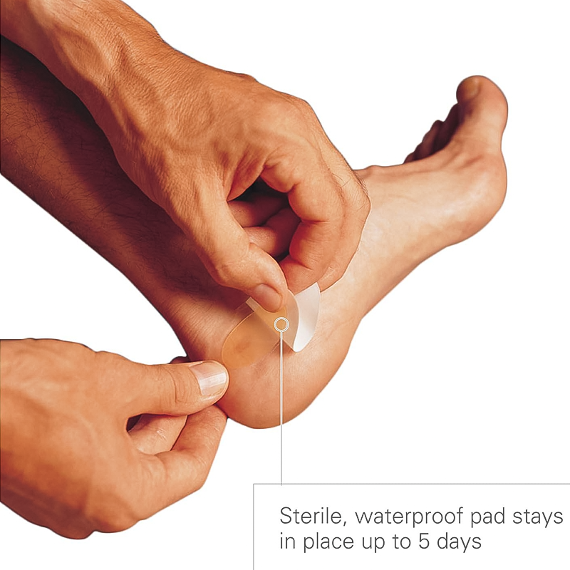 Spenco 2nd Skin Blister Sterile Pads